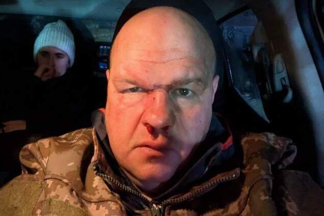 На Тернопільщині мажори після влаштованої ДТП побили військового і намагались зам'яти справу 'за допомогою ТЦК': розгорівся скандал. Відео