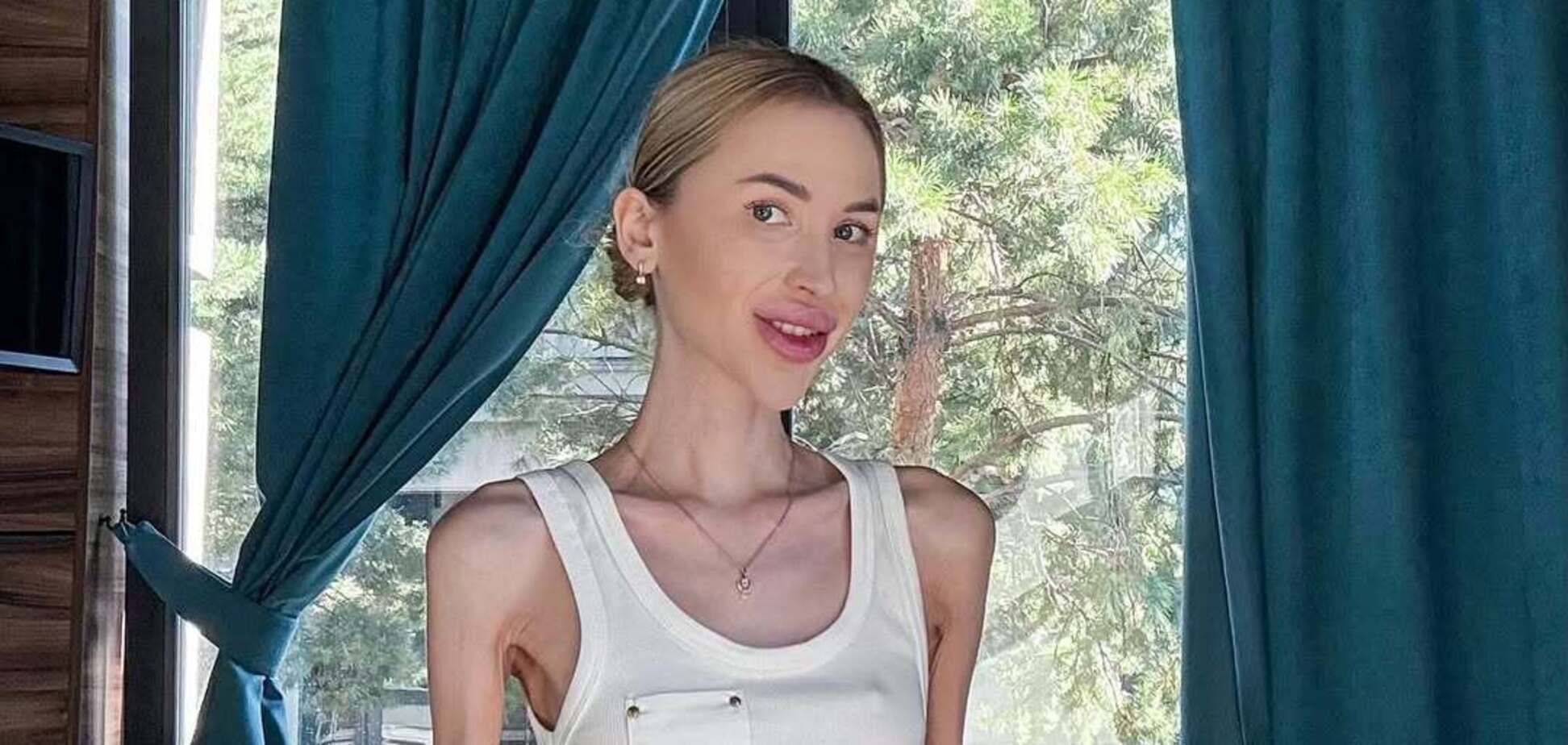 У школі Києва виник скандал через Аліну Ліпницьку, яка важить 29 кг і транслює російськомовний контент: усі деталі та реакція самої блогерки