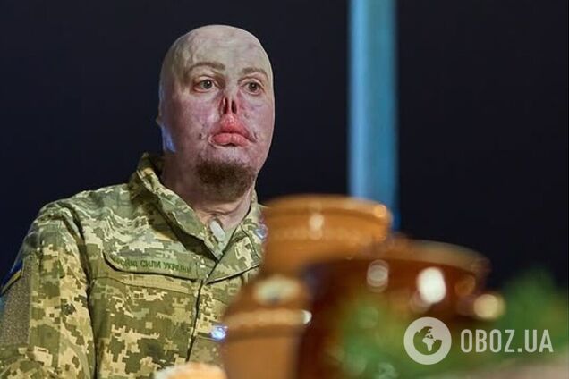 'Мені подобається все в моєму житті'. Незламний ветеран, який отримав важкі опіки, знайшов кохання в інтернеті. Фото пари