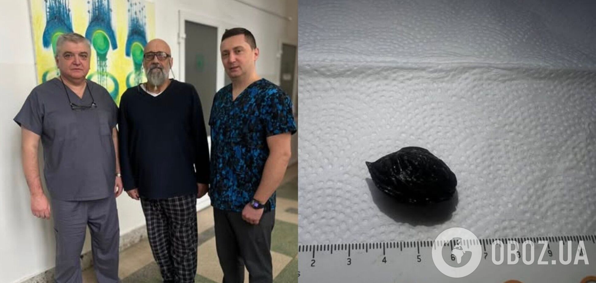 Во Львове спасли мужчину, который едва не умер из-за персиковой косточки. Фото