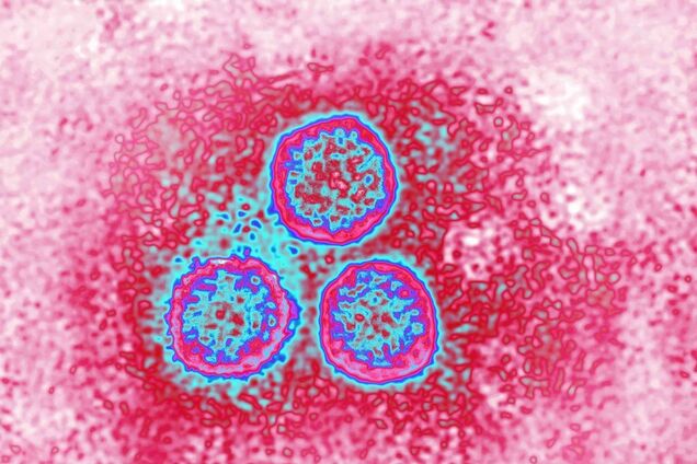 Чому не можна видаляти папіломи в домашніх умовах: популярна помилка, яка може нашкодити