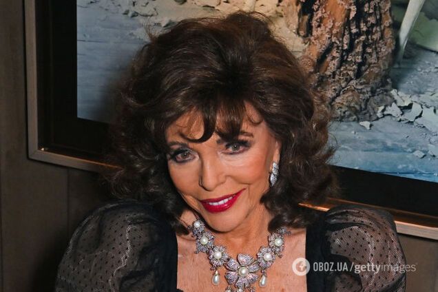 92-річна зірка 'Династії' Джоан Коллінз попередила жінок про популярну процедуру 'краси', яка спотворює обличчя