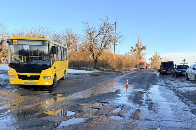 На Киевщине микроавтобус сбил 12-летнюю девочку: ребенок в тяжелом состоянии в больнице. Подробности ДТП и фото