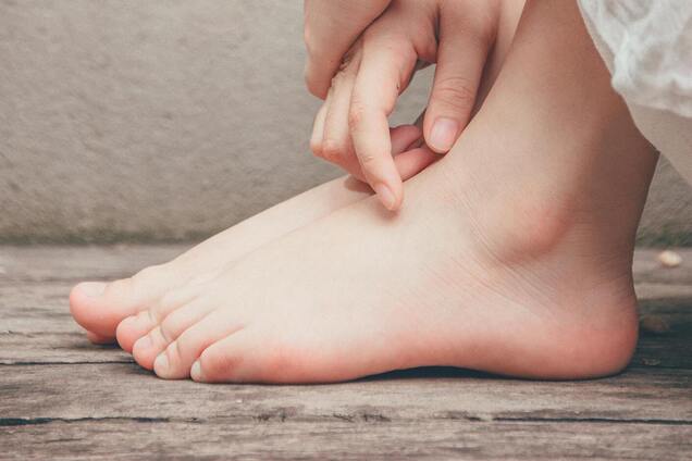 Как уберечь ноги от пота и грибка: поможет продукт из кухни