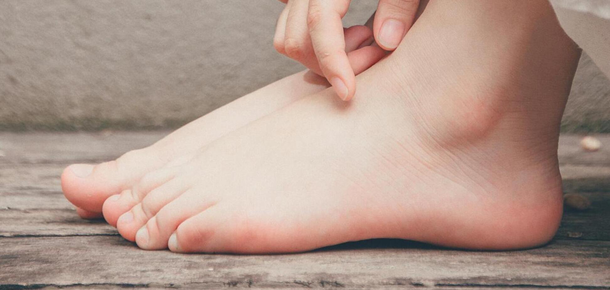 Как уберечь ноги от пота и грибка: поможет продукт из кухни