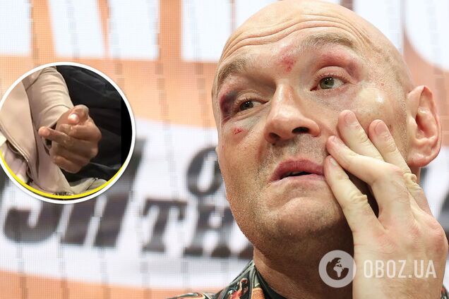 Фьюри после победы над россиянином бросил вызов знаменитому супертяжу. Тот в ответ показал средний палец. Фотофакт