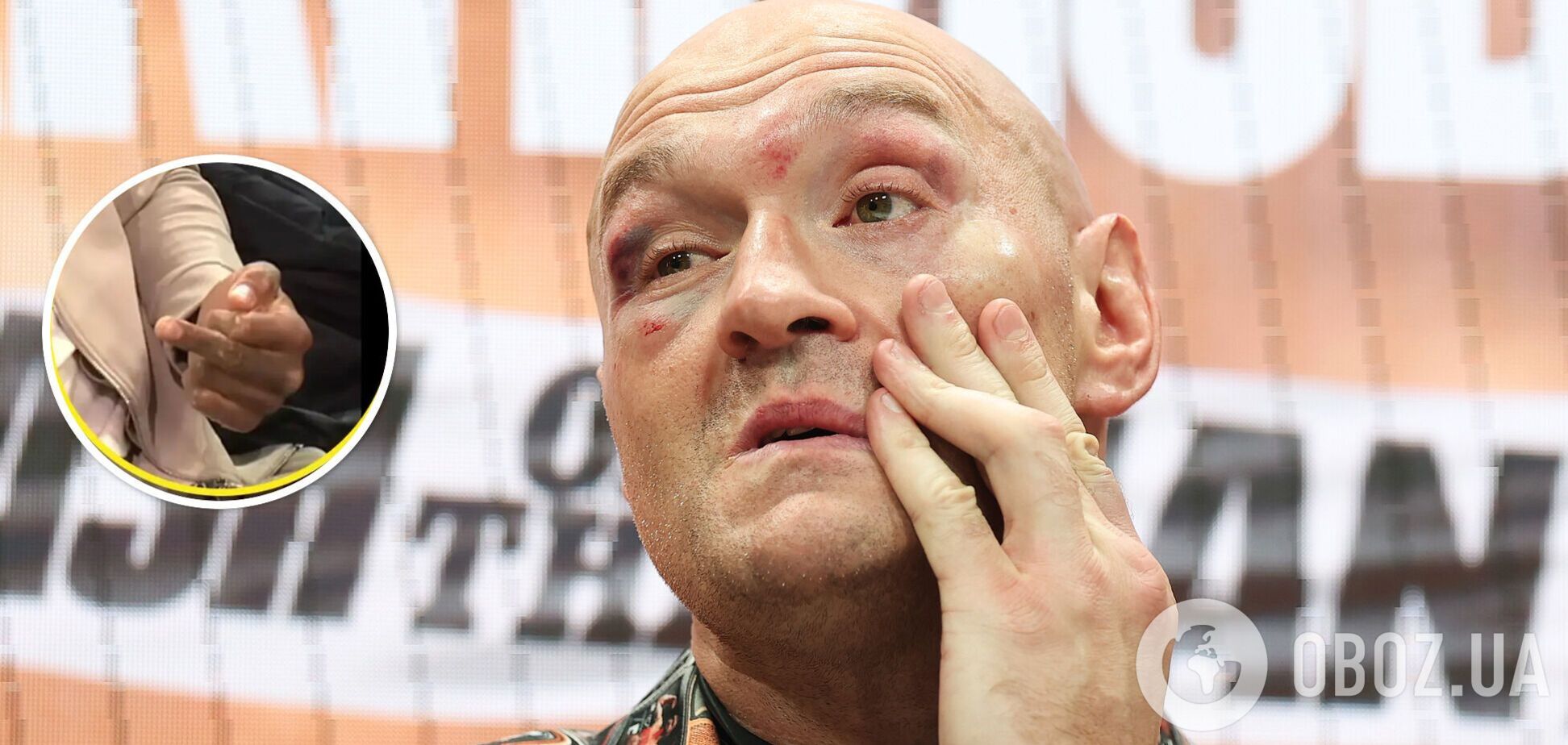 Ф'юрі після перемоги над росіянином кинув виклик знаменитому супертяжу. Той у відповідь показав середній палець. Фотофакт