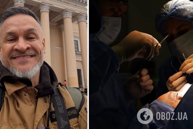 Ектор Хіменес-Браво зробив пластичну операцію та показав, який вигляд має його обличчя тепер. Фото