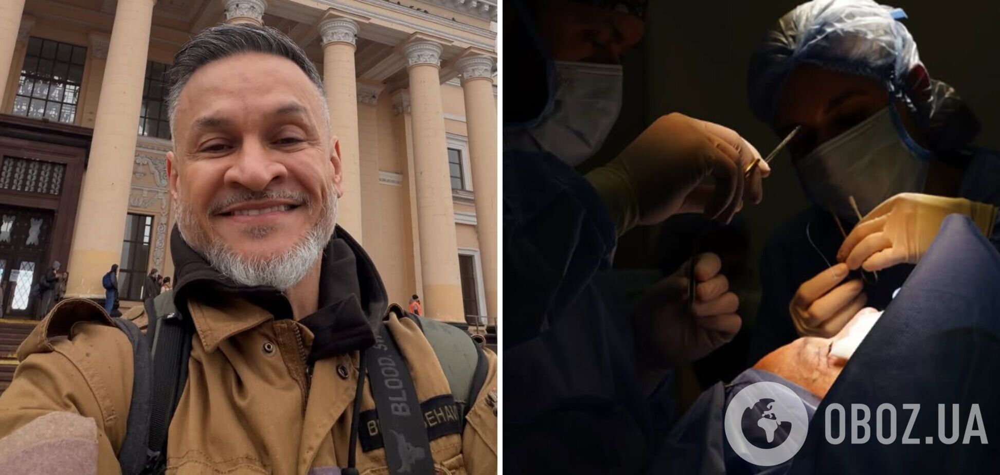 Эктор Хименес-Браво сделал пластическую операцию и показал, как выглядит его лицо теперь. Фото