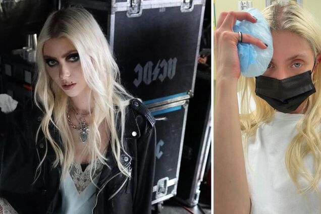 Солістку The Pretty Reckless і зірку 'Пліткарки' з українським корінням вкусив отруйний павук: вона нажахала своїм виглядом у лікарні