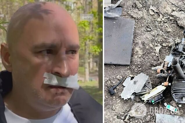 В Днепре обломки 'Шахеда' сдетонировали в момент, когда мимо проходил мужчина: пострадавший рассказал о взрыве. Видео