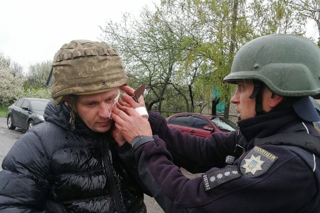 На Днепропетровщине мужчина бросил гранату в полицейских: пятеро раненых. Фото
