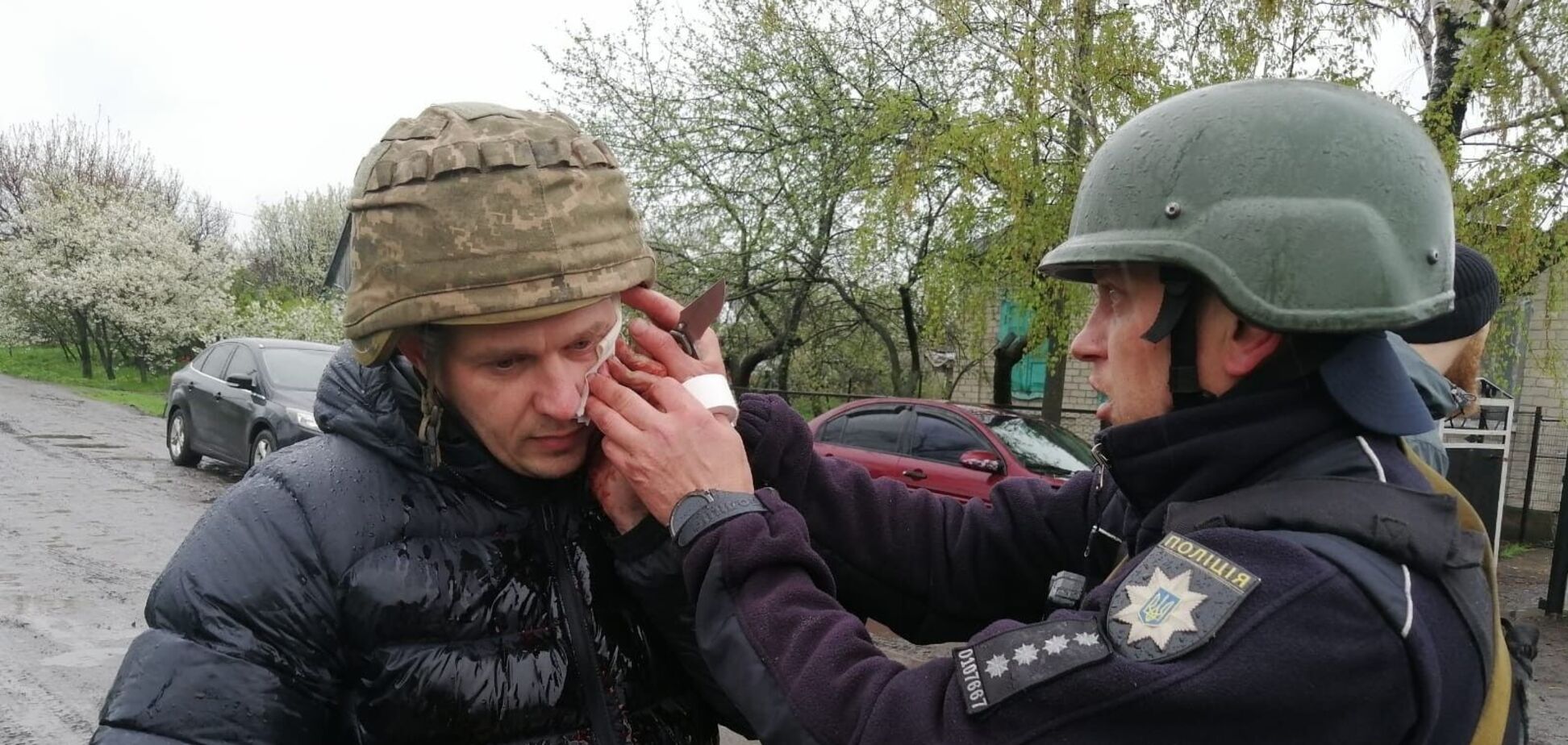 На Днепропетровщине мужчина бросил гранату в полицейских: пятеро раненых. Фото