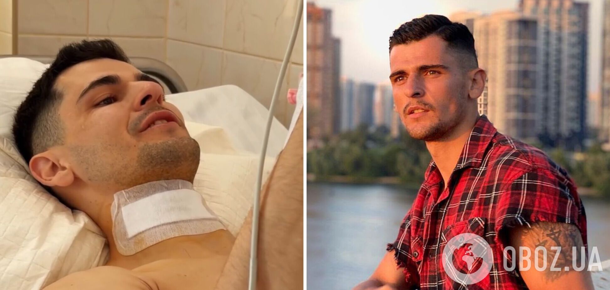 'Три роки жив на терапії і знеболювальних': Ніколас Карма переніс небезпечну для життя операцію на шиї. Відео