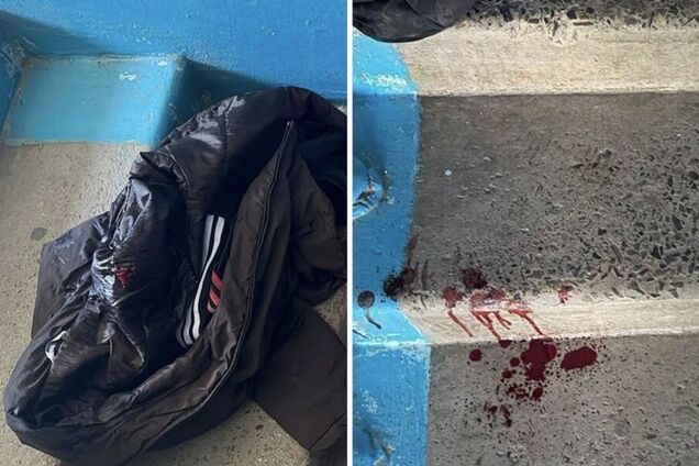 В Тернополе произошла поножовщина между несовершеннолетними девушками: одну из них забрали в реанимацию. Фото