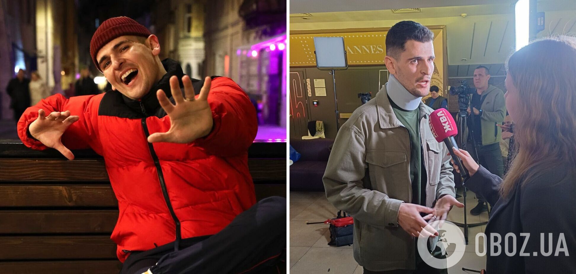 Ніколас Карма, який пережив термінову операцію, розповів про складний імплант у шиї та різке схуднення на 10 кілограмів