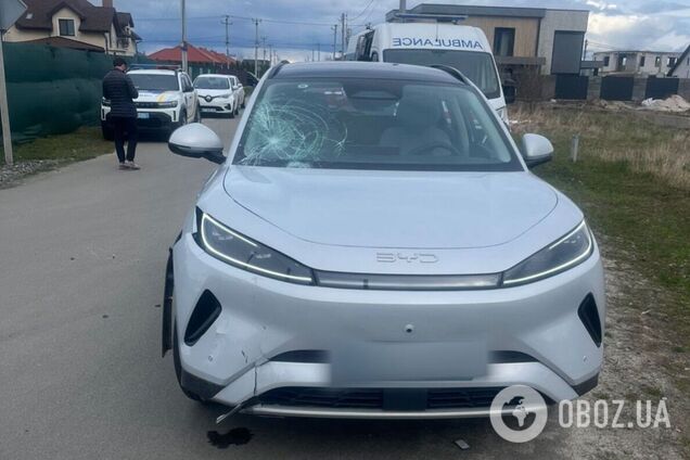 Під Києвом зіткнулися електросамокат і легковик: постраждали двоє 12-річних хлопців. Подробиці та фото