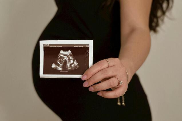 Є лише у вагітних: вчені виявили новий тип клітин