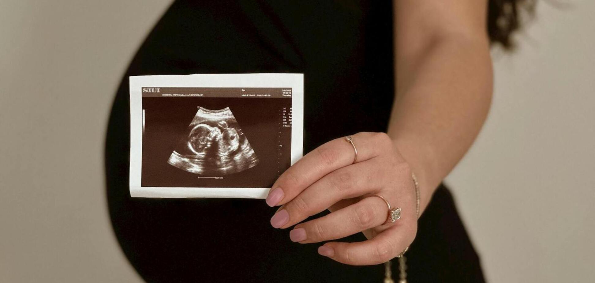 Есть только у беременных: ученые обнаружили новый тип клеток