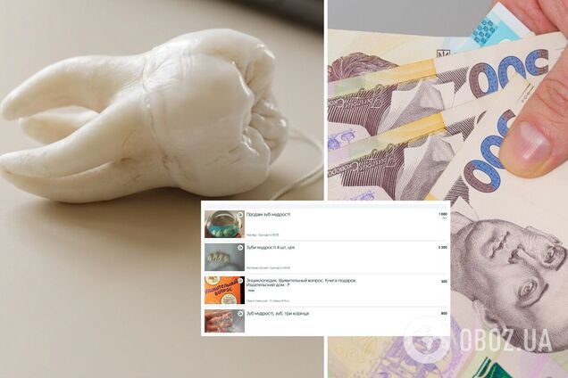 Зуб мудрости, гривни и объявления о продаже. Иллюстративный коллаж