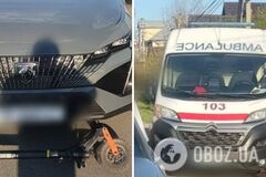На Київщині легковик зіткнувся з електросамокатом із дітьми: загинув 10-річний хлопчик. Фото