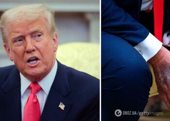 Белый дом раскрыл причину загадочных синяков на руках Трампа: перед смертью такие же замечали у Елизаветы II