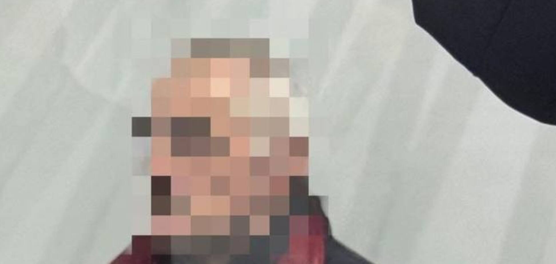 В Сумах будут судить мужчину, который из ружья ранил подростков, потому что не освободили скамейку: подробности дела