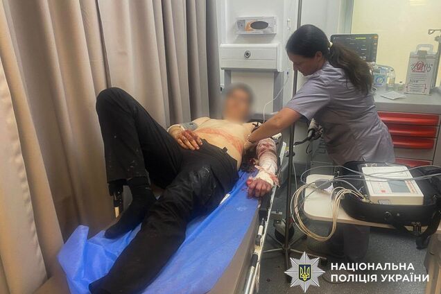 У Запоріжжі під час обшуку озброєний чоловік поранив трьох поліцейських: злочинця ліквідували. Фото