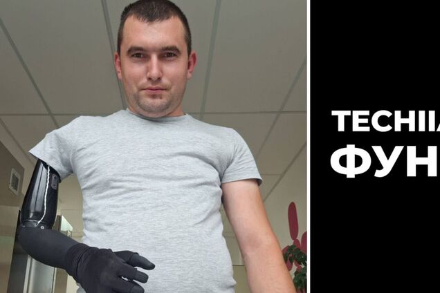 Протезування провели в межах ініціативи Esper for Ukraine
