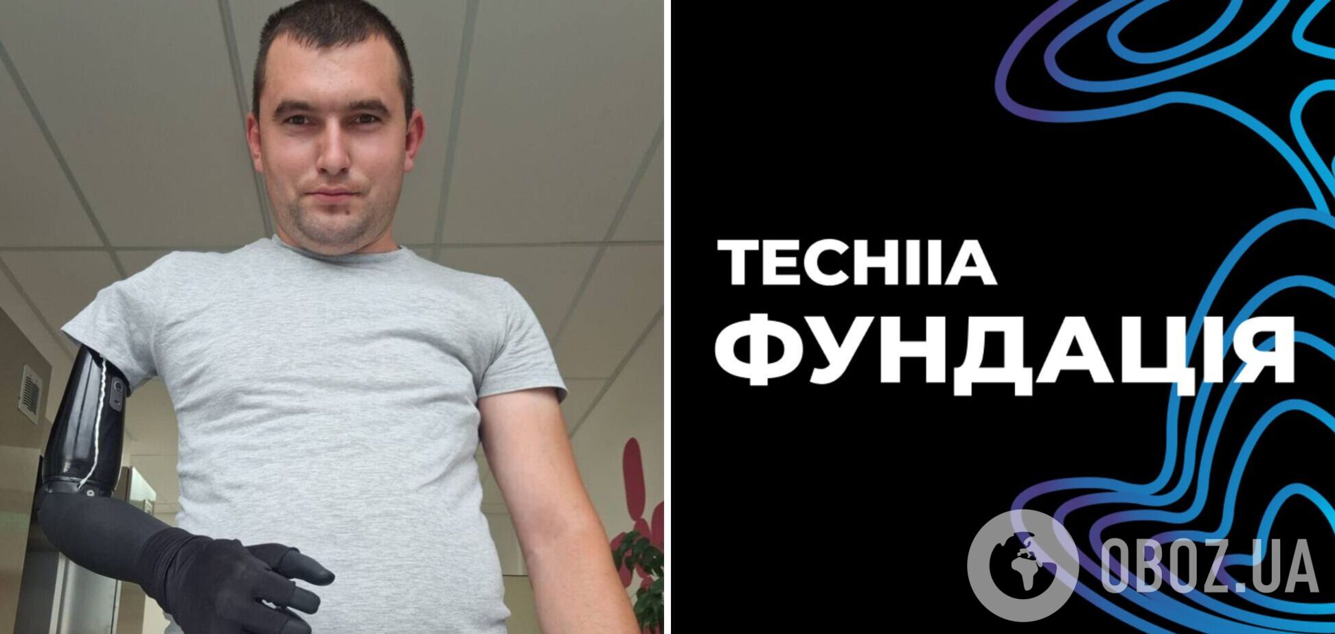Протезування провели в межах ініціативи Esper for Ukraine