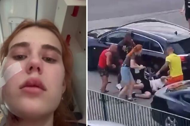У Польщі хлопця і дівчину побили біля магазину через український акцент: постраждалі в лікарні
