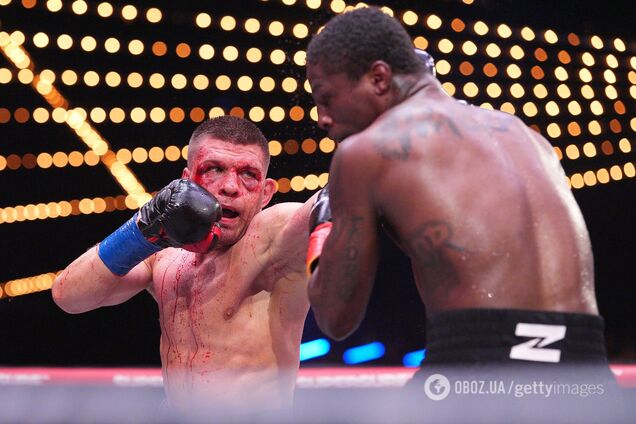 Український чемпіон без корони з закривавленим обличчям влаштував чергову війну в елітному шоу у Нью-Йорку, вразивши журналістів