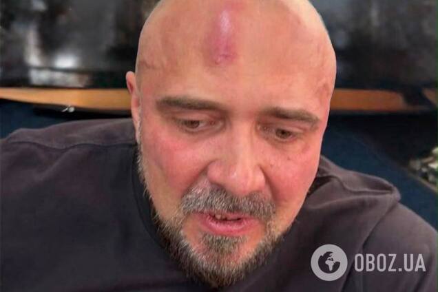 'Українська бронетехніка' заявила про побиття свого першого заступника директора співробітниками СБУ