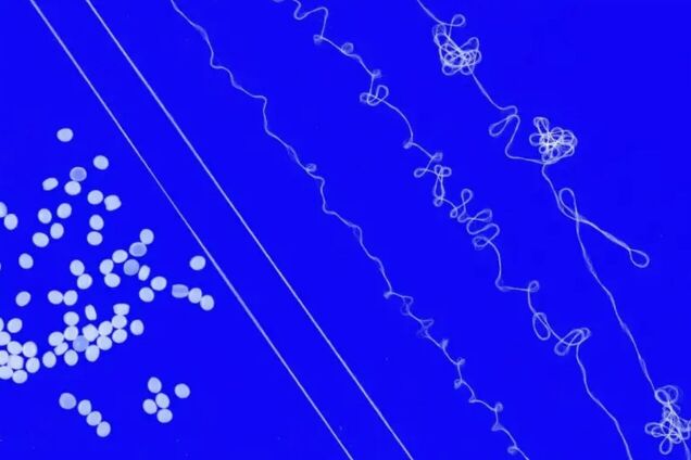 Лучше, чем спандекс: ученые разработали пряжу из пластика, которую можно перерабатывать бесконечно
