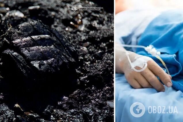 Врачи боролись за его жизнь более двух недель: скончался 20-летний молодой человек, пострадавший в результате атаки РФ на Днепр