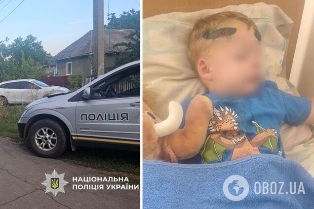 'Дитина була у крові': батько 2-річного хлопчика, на якого наїхав працівник ТЦК на Одещині, розповів, що сталося. Фото