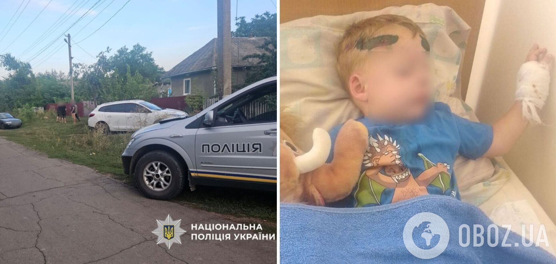 'Дитина була у крові': батько 2-річного хлопчика, на якого наїхав працівник ТЦК на Одещині, розповів, що сталося. Фото